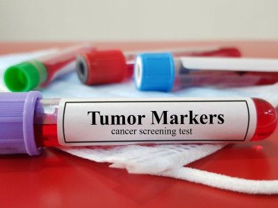 early-tumor-detection